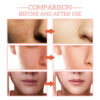 FORT 5IN1 Whitening Serum | Brighten Skin Tone, Removes Dead Skin Whitening Serum | 30ML
